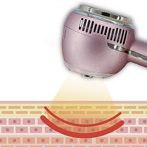 ウルトラプローブ