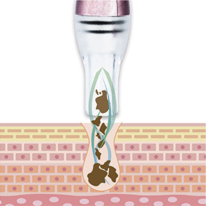 バキュームプローブ