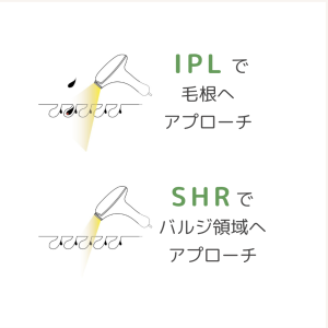 IPLとSHR